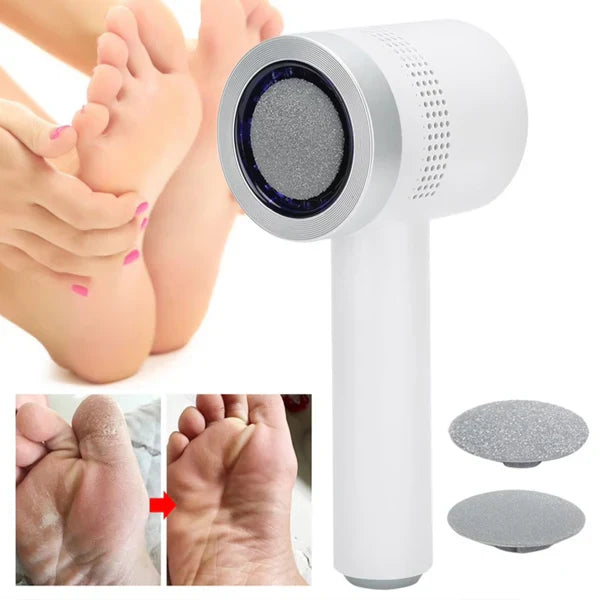 N2 ReCalus Foot Callus Remover US46