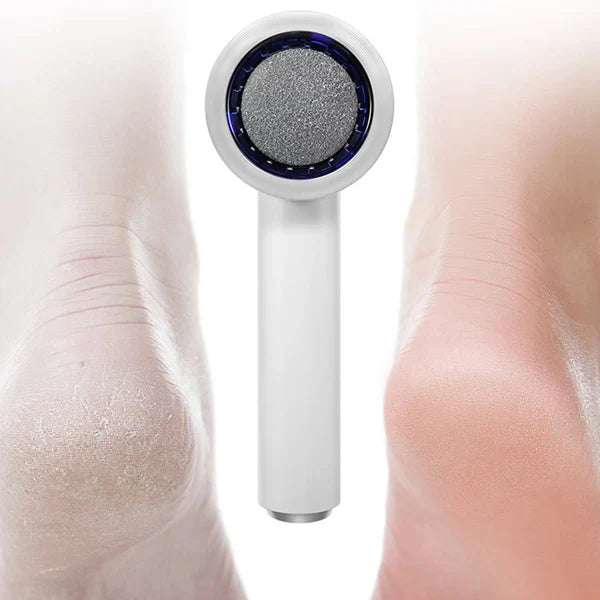 N2 ReCalus Foot Callus Remover US46