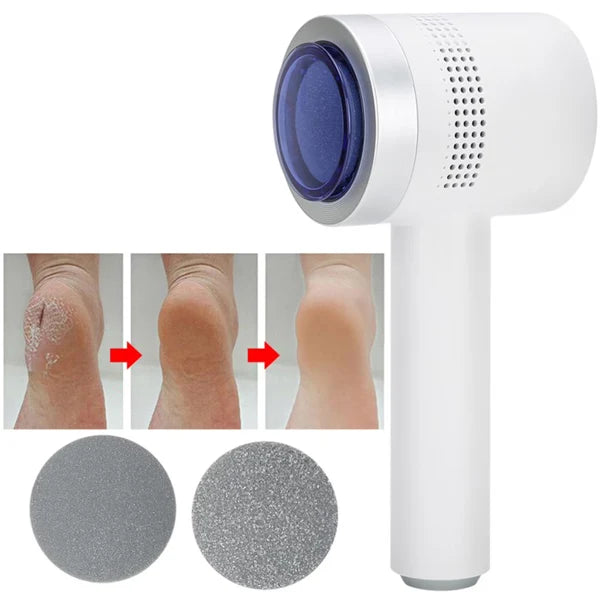 N2 ReCalus Foot Callus Remover US46