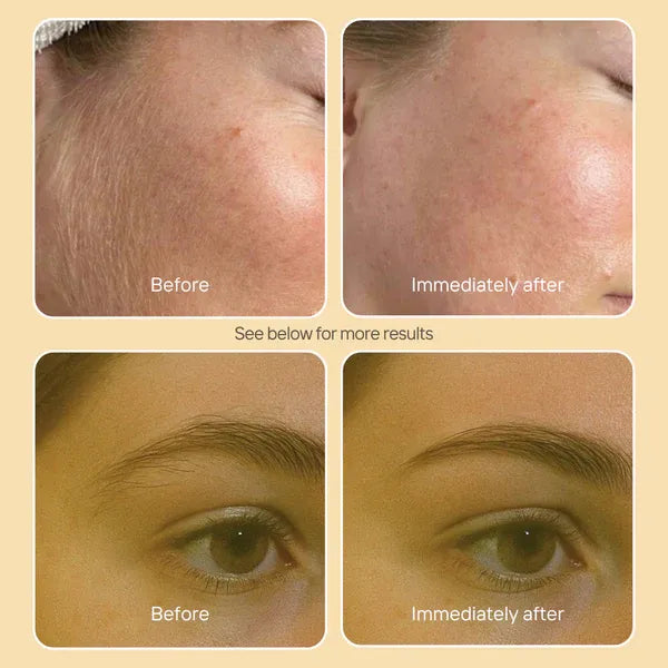 LumaSkin Dermaplaning Tools US13